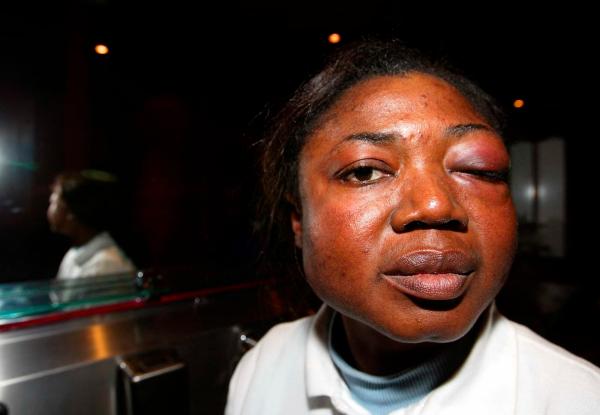 11/01/03.-SOPHI AMOJ AMOGBOKPA (39) From London toilet attendant at The Drink in Guildford beaten up  and racially abused by Girls Alound member.