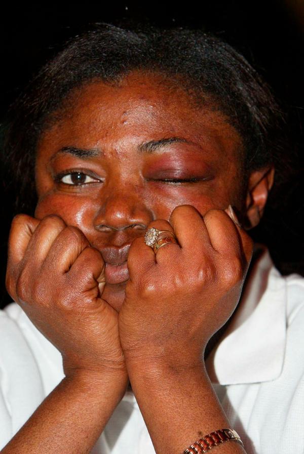 11/01/03. SOPHI AMOJ AMOGBOKPA (39) From London toilet attendant at The Drink in Guildford beaten up  and racially abused by Girls Alound member.